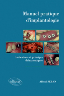 Manuel pratique d'implantologie - Indications et principes thérapeutiques