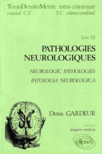 Imagerie médicale - TDM 3 Pathologies neurologiques